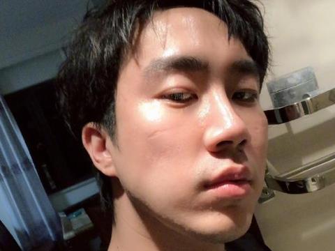 kycom-冬季皮肤瘙痒或为保暖内衣所致(图3)