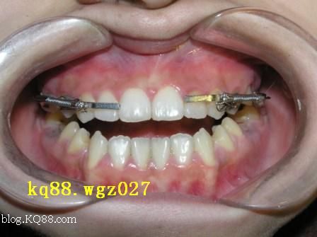 “kycom”排尿痛可能是阴道炎发作(图2)