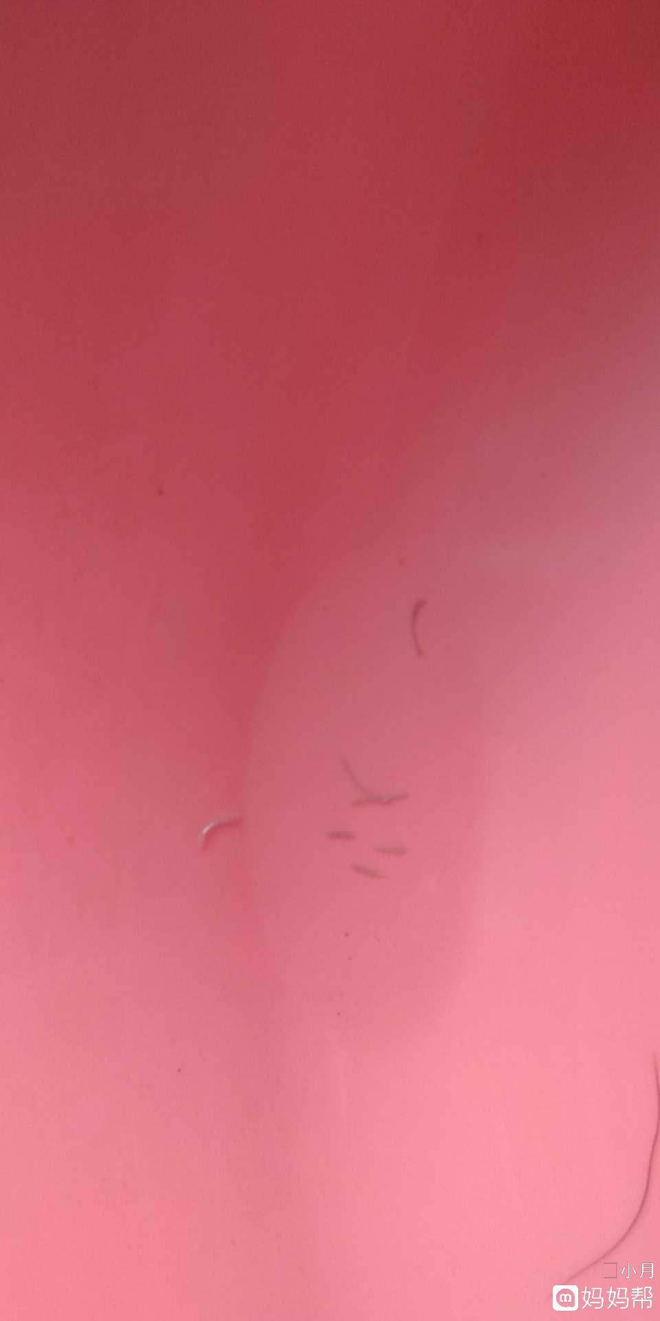 “ky.com”皇马官方：拉莫斯左腿比目鱼肌水肿(图2)