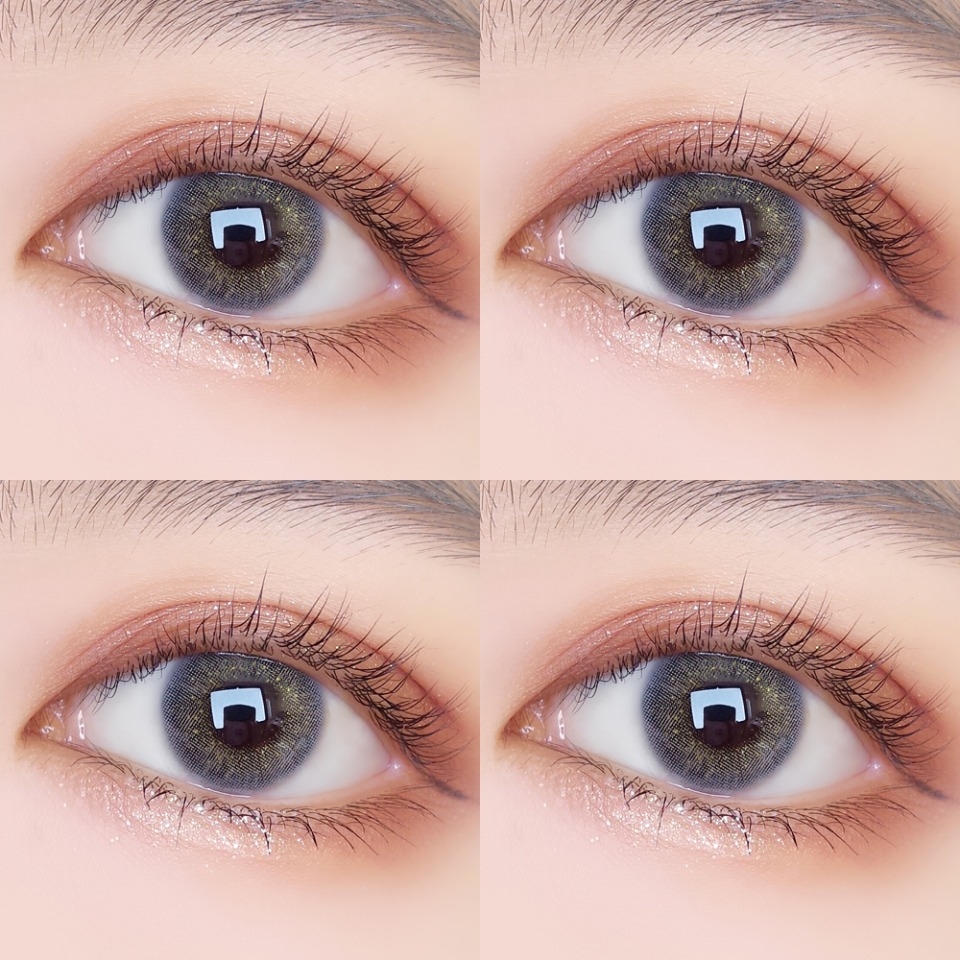 ‘kycom’阴道炎,女性危害(图1)